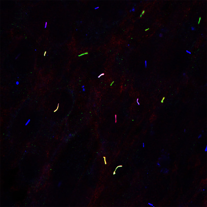 UTSW scientists link another gene to obesity